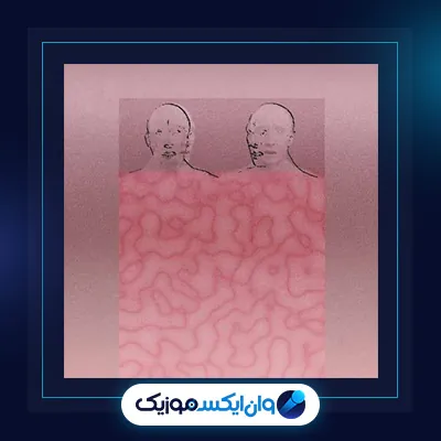 بیم